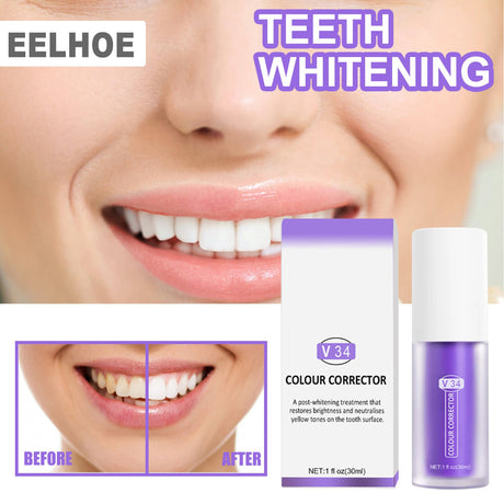 Teeth Intensive Whitening Toothpaste - Atlantic Shopping Mall